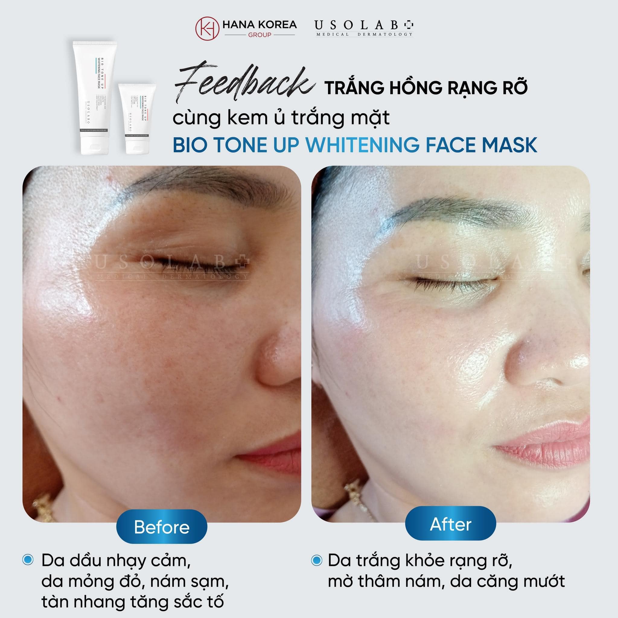 USOLAB Derma clean thanh lọc da dầu 