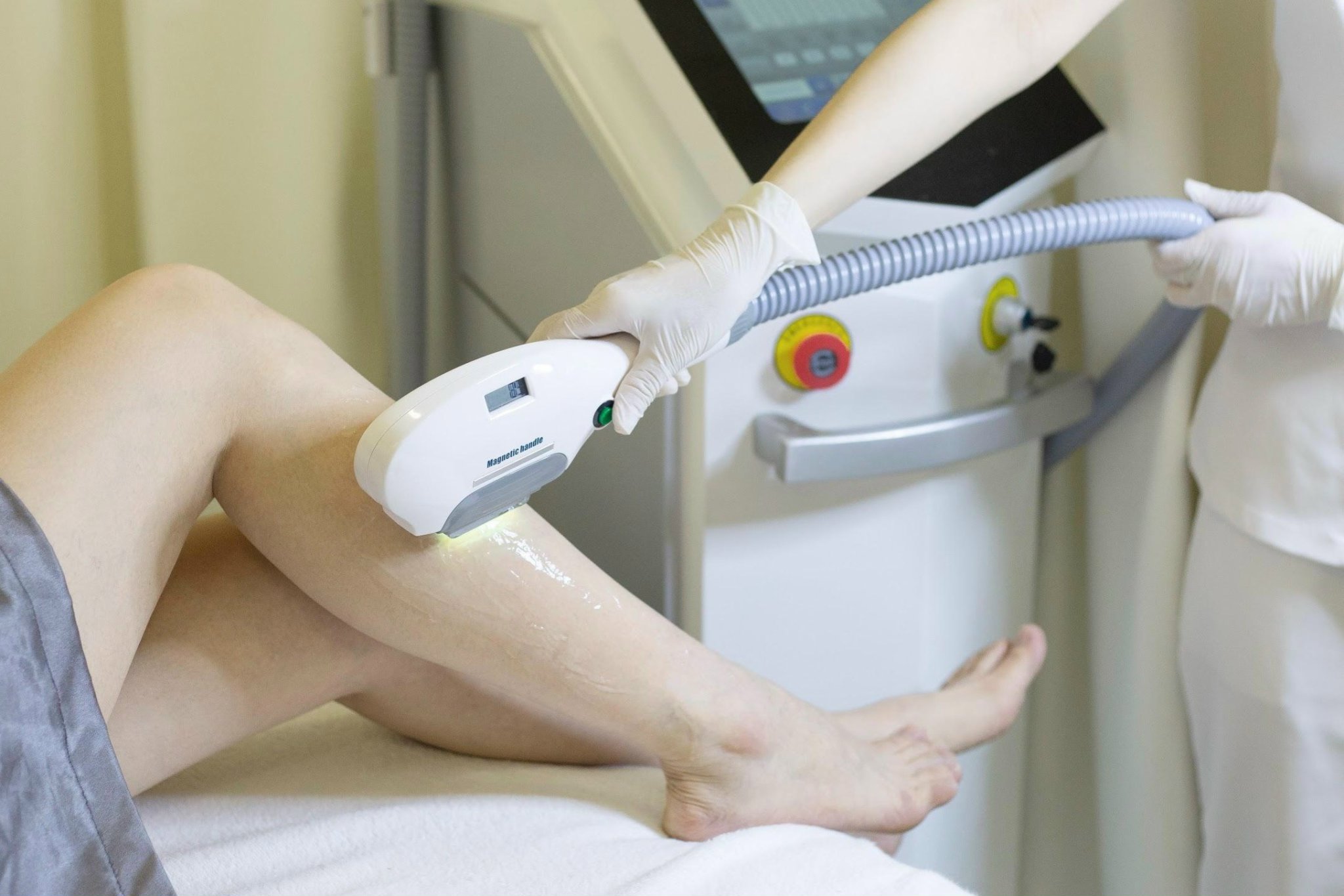 ( Pack 3 buổi ) Hair Removal Triệt lông 1/2 chân 